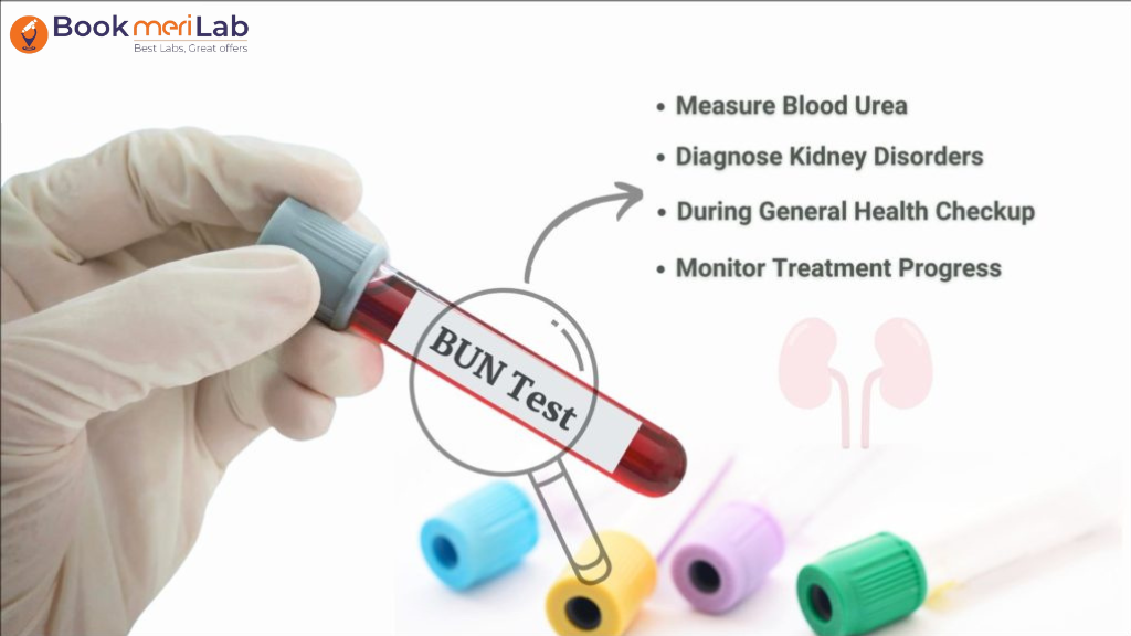 blood urea nitrogen