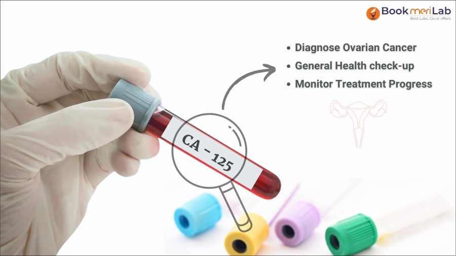 Ca 125 test
