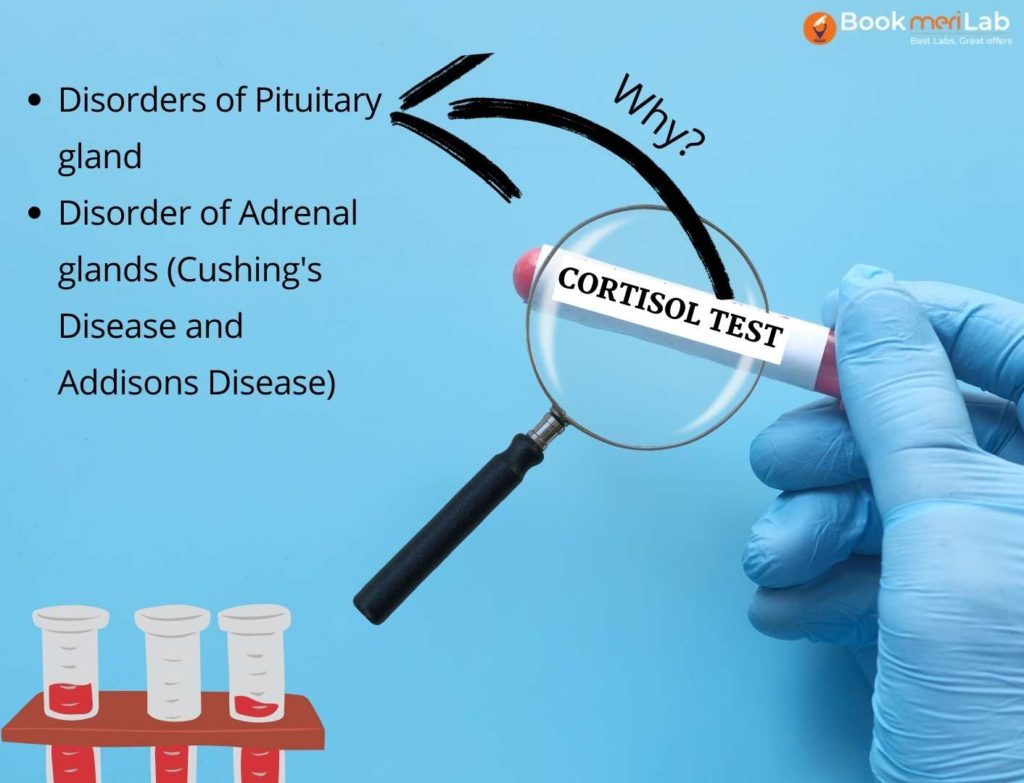 Cortisol Test Purpose
