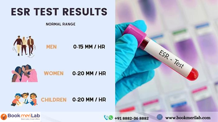 esr test, est test normal range, esr test results, normal range of esr test
