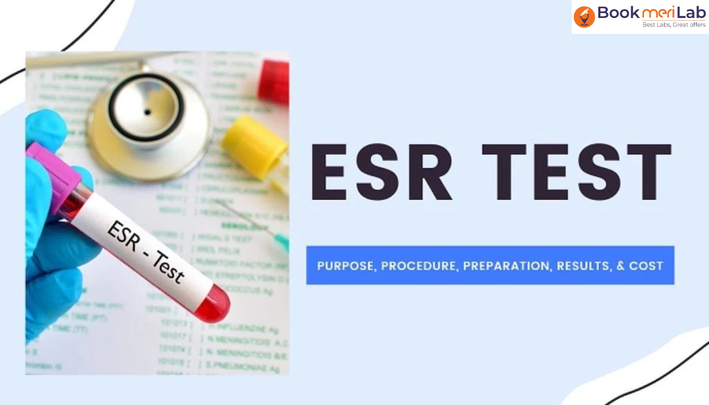 ESR Test