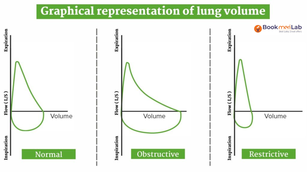 Graphical representation of lung volume