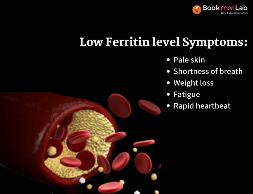Low Ferritin level Symptoms
