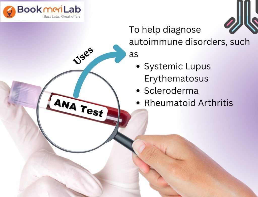 ANA Test Purpose