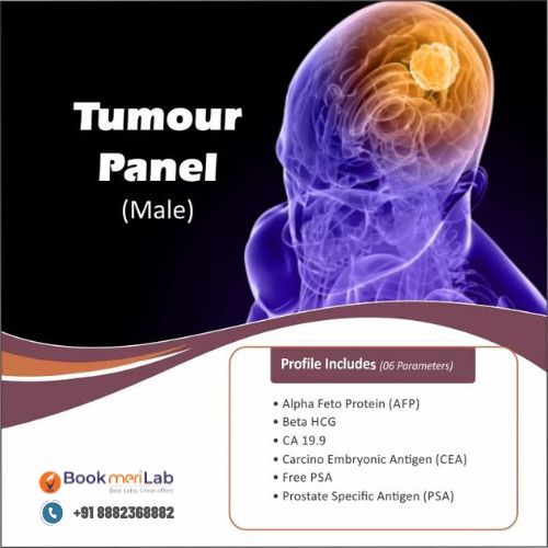 Tumour Profile Male