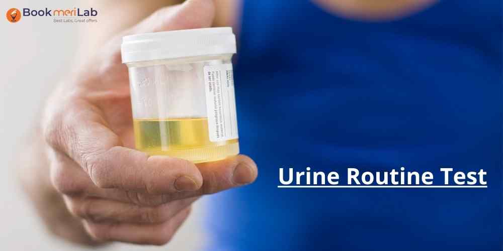 urine test sampl