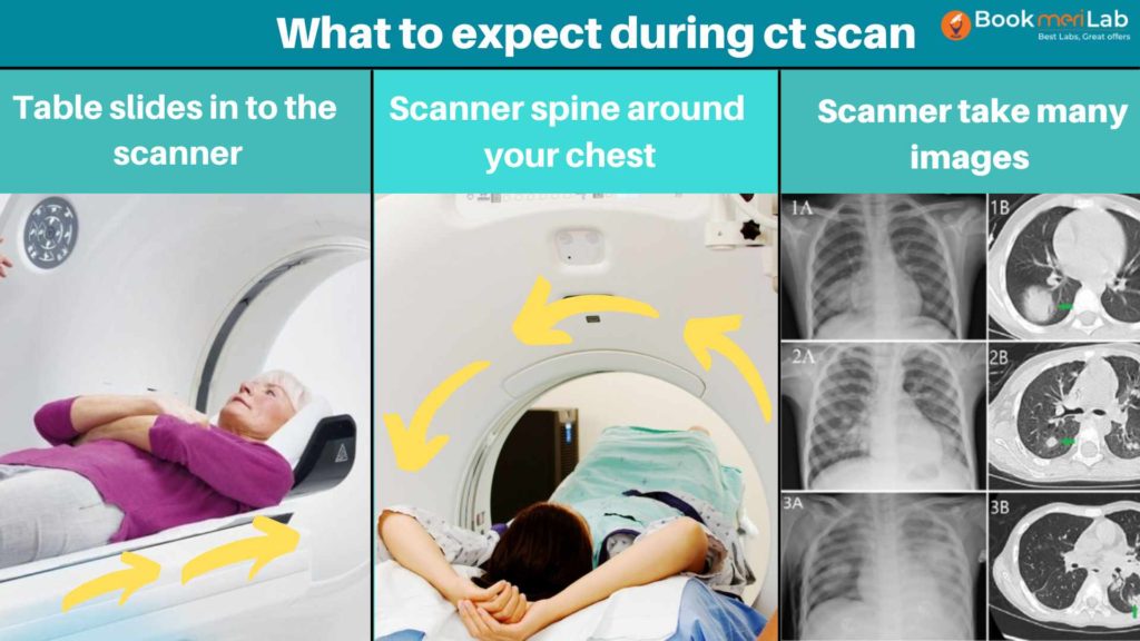 ct chest procedure