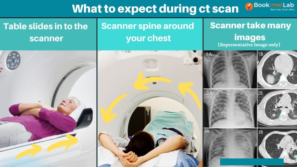 What to expect during ct scan