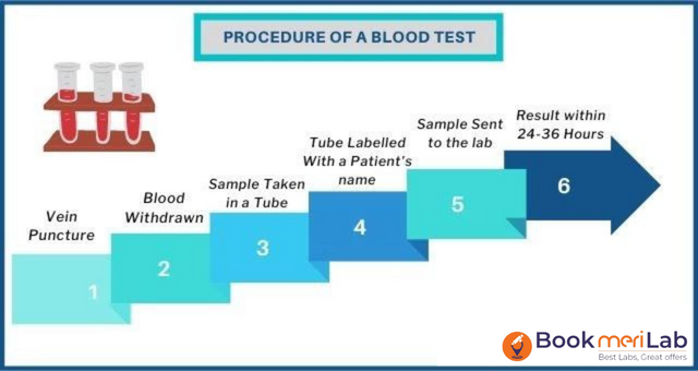 Blood test procedure