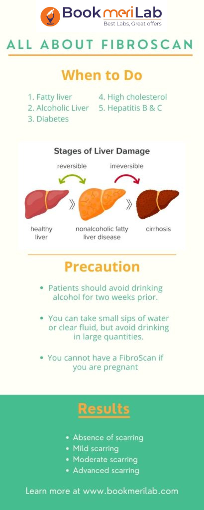 fibroscan test infographics
