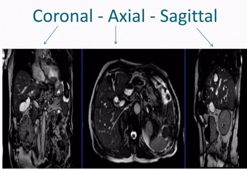 Coronal, axial and sagittal angles of abdominal MRI