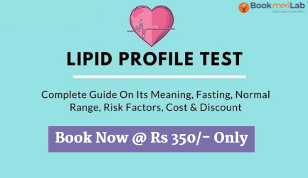 Lipid Profile Test Guide with Cost