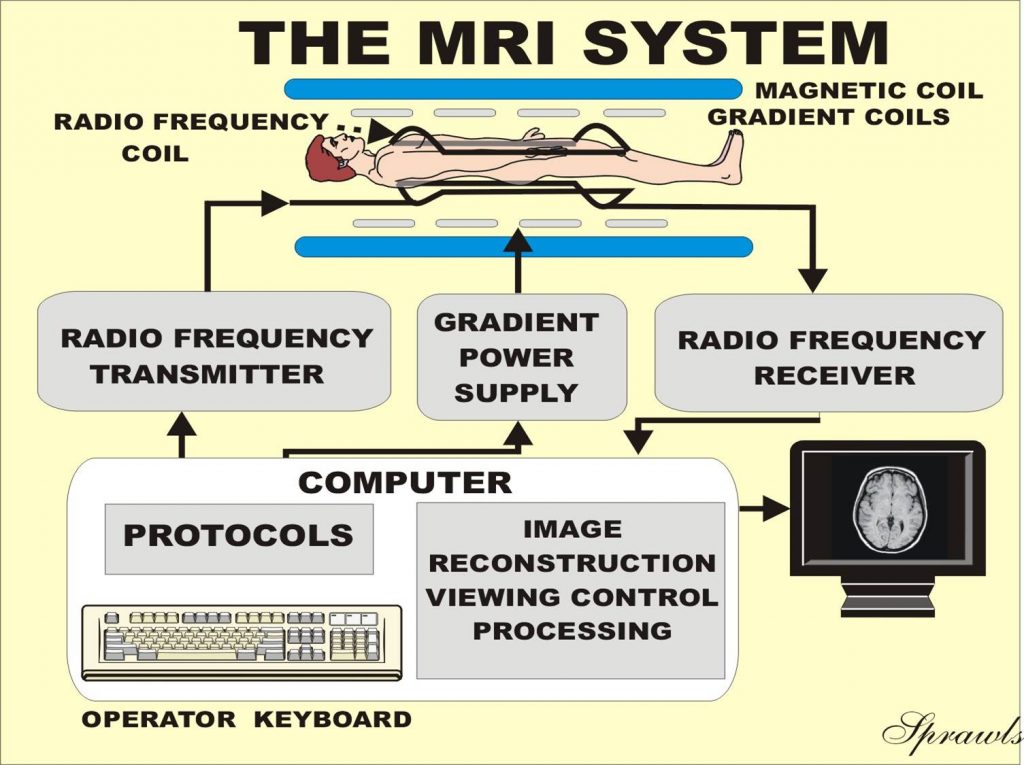 MRI macine system