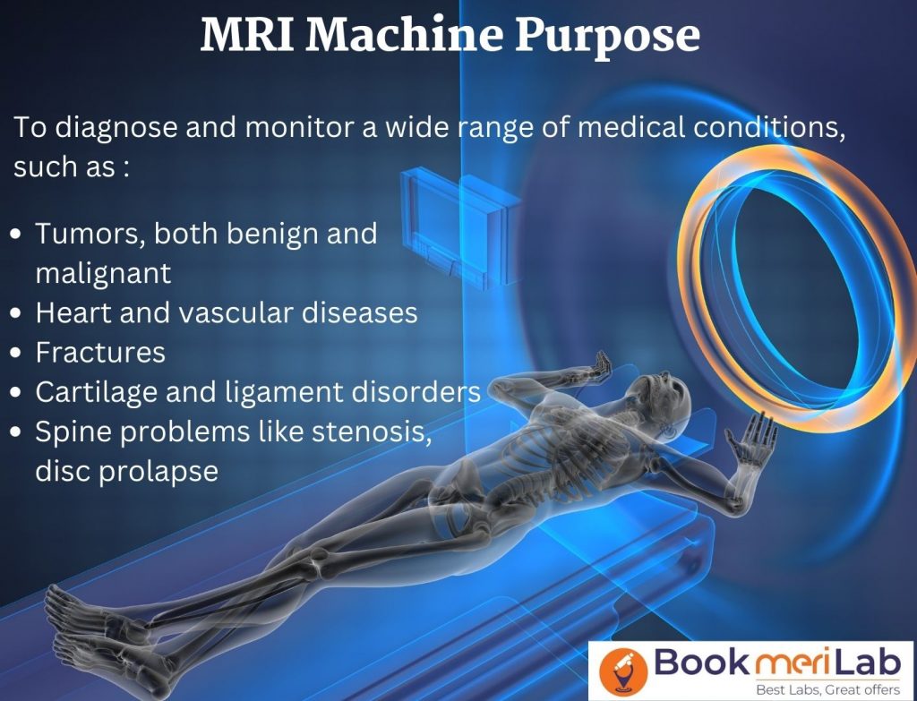 MRI Machine Purpose