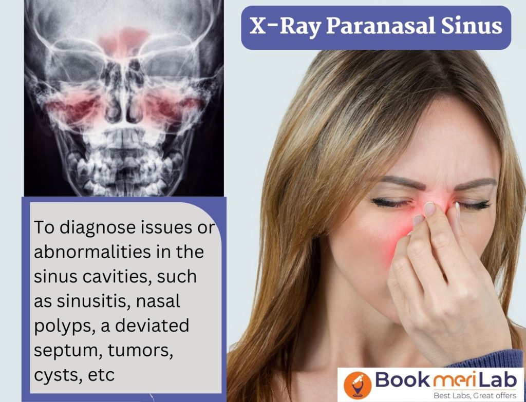 X-Ray Paranasal Sinus (PNS)