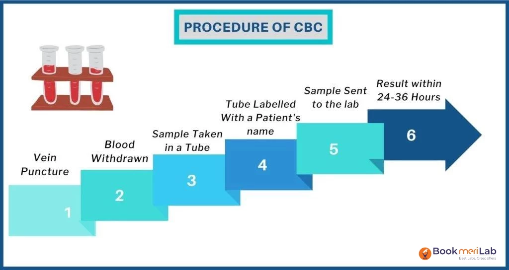 cbc test procedure