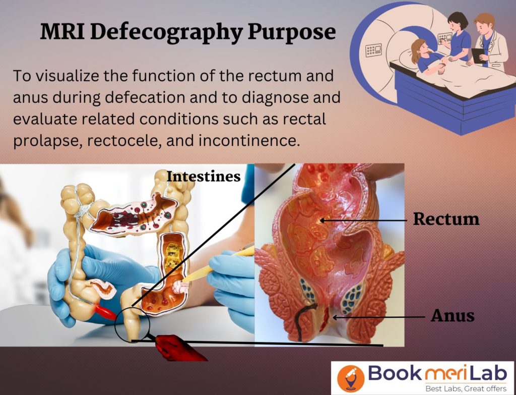 purpose of MRI Defecogram