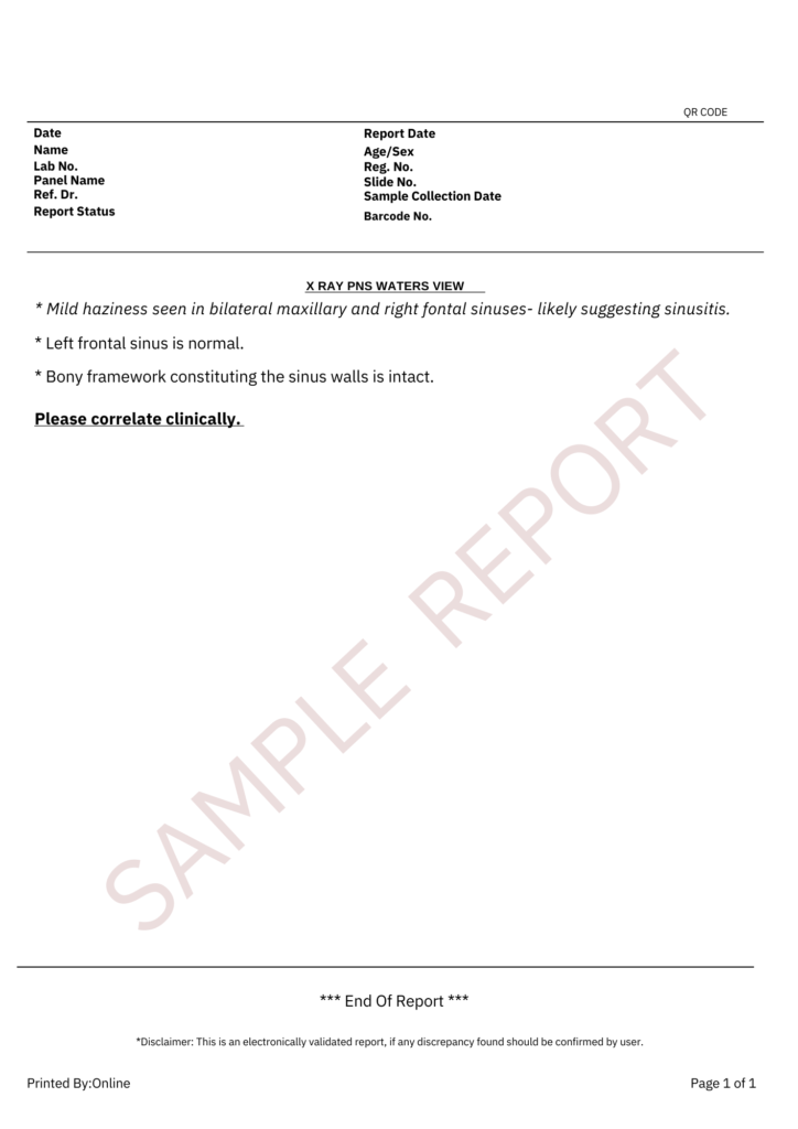 X-Ray Paranasal Sinus Sample Report