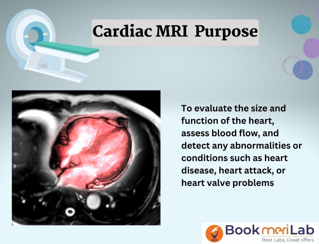 Cardiac MRI Purpose