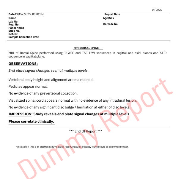 sample report for mri dorsal spine