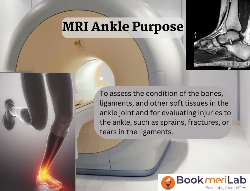 mri ankle purpose