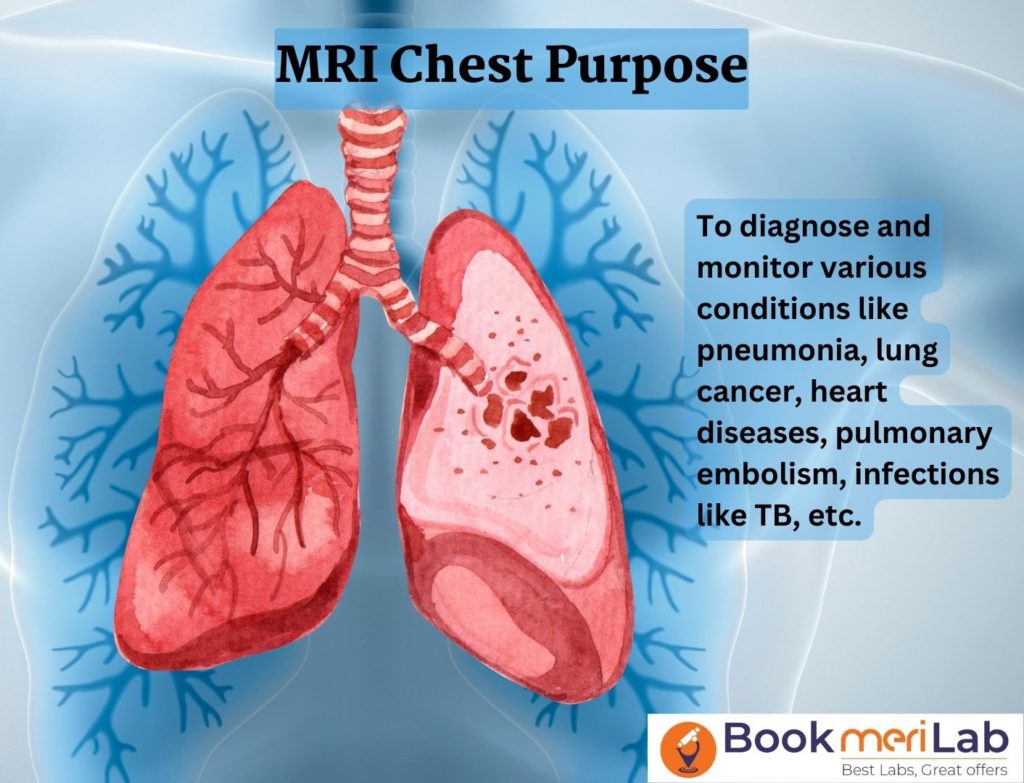 MRI Chest Purpose