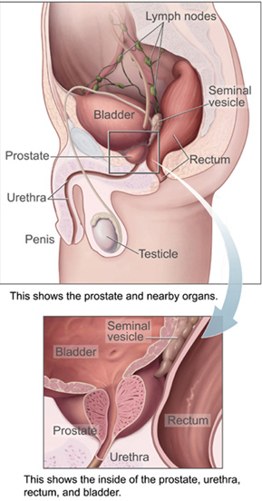 Diagram showing prostate and nearby organs