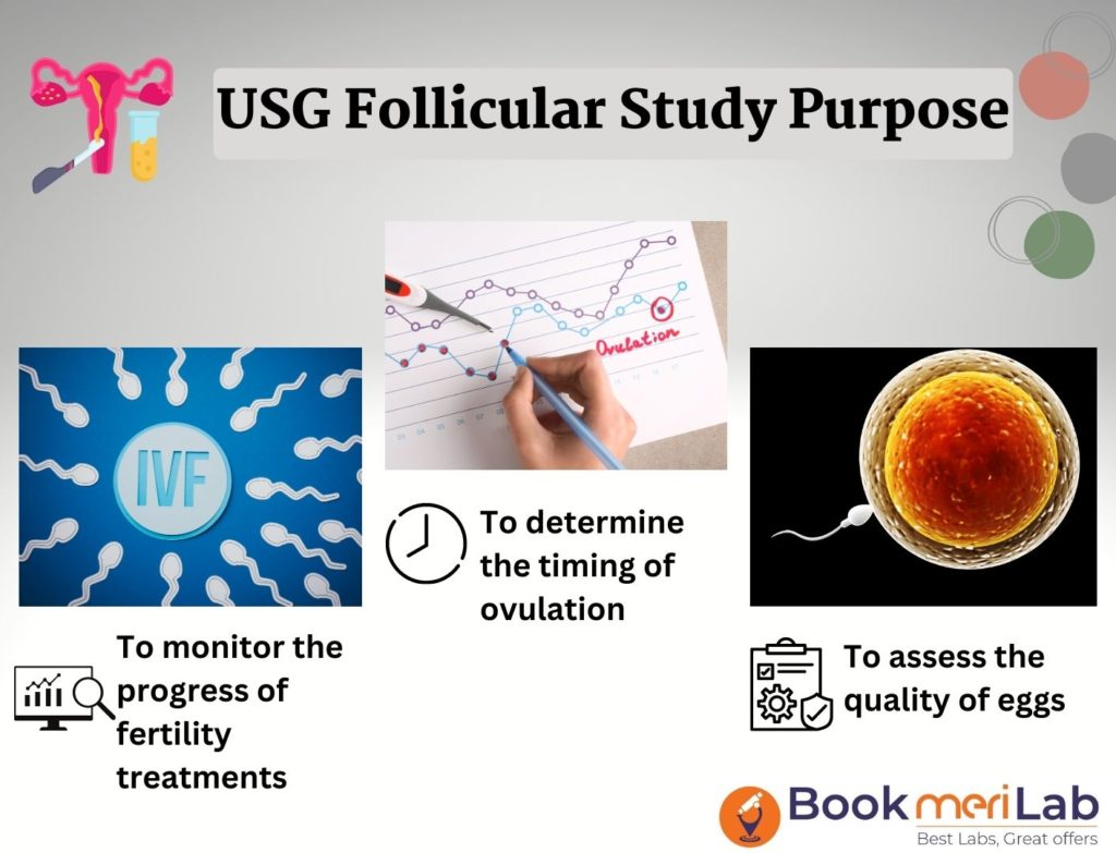 USG Follicular Study Purpose