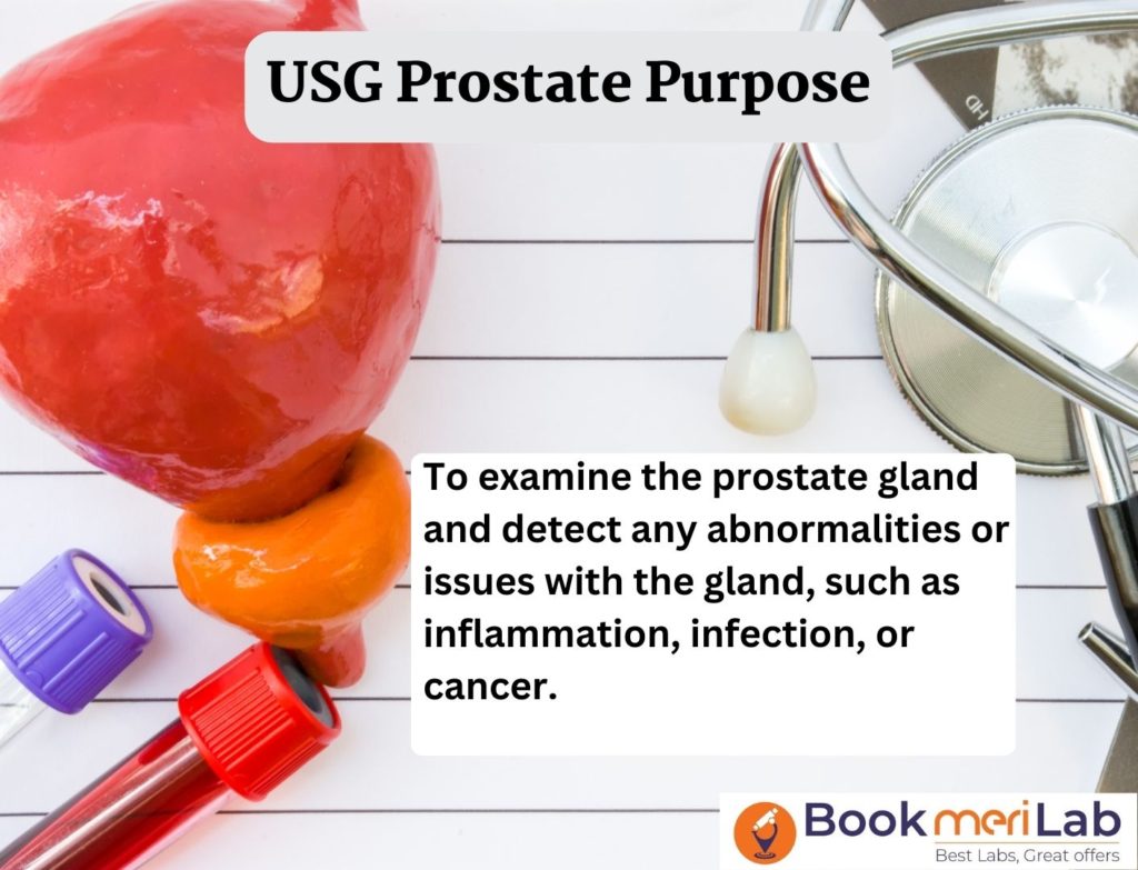 USG Prostate Test Purpose