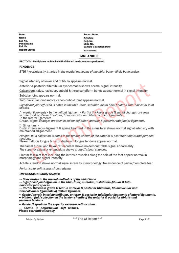 mri ankle sample report