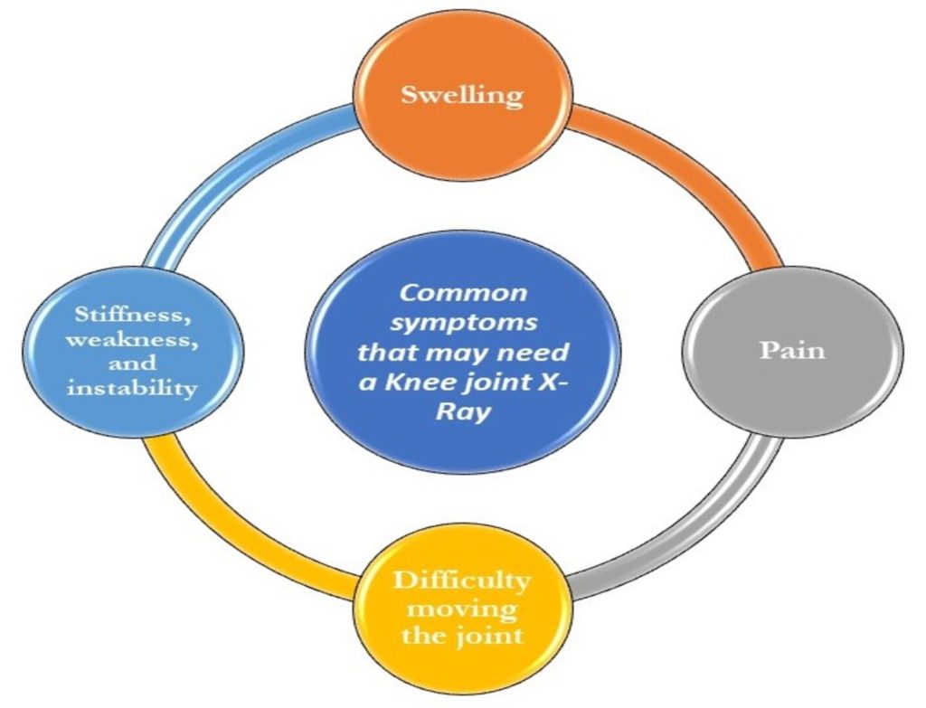 Symptoms related to knee joint conditions