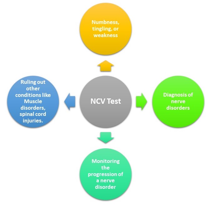 NCV test
