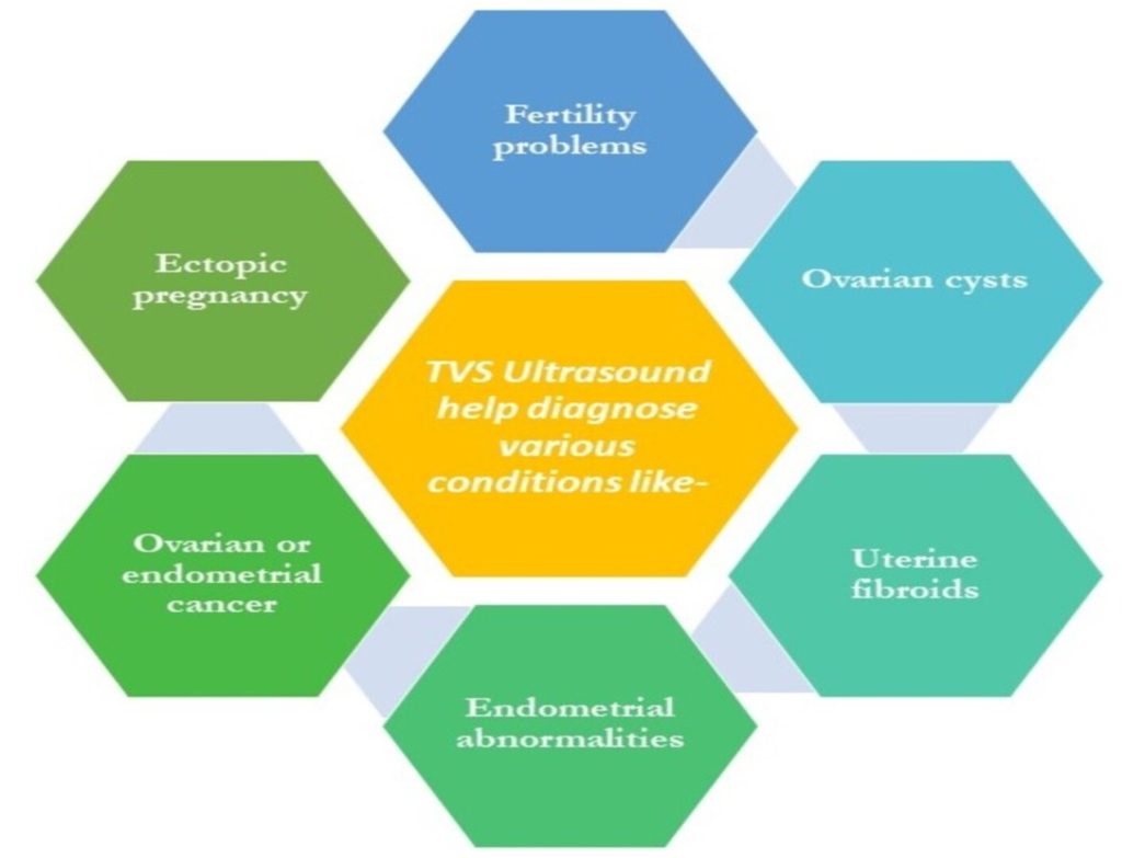 Conditions diagnosed by TVS USG