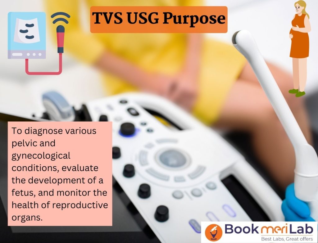TVS USG PURPOSE