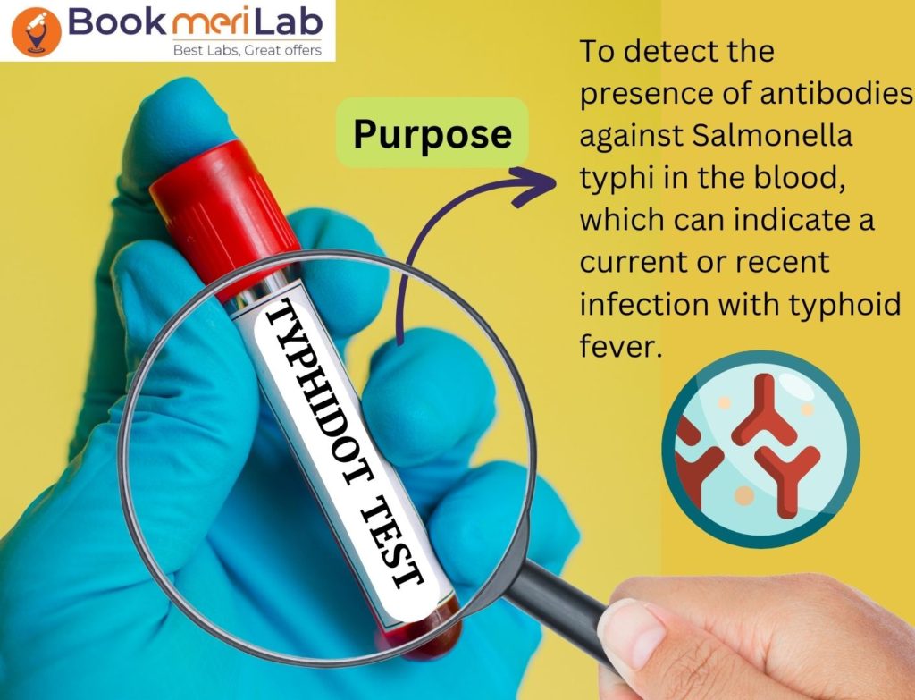 TYPHIDOT TEST PURPOSE