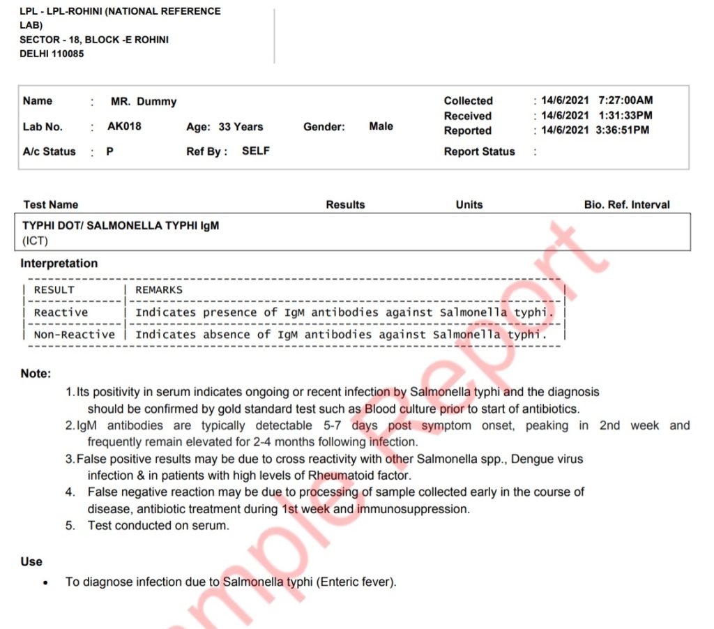 typhidot sample report