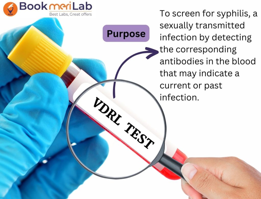 VDRL TEST PURPOSE