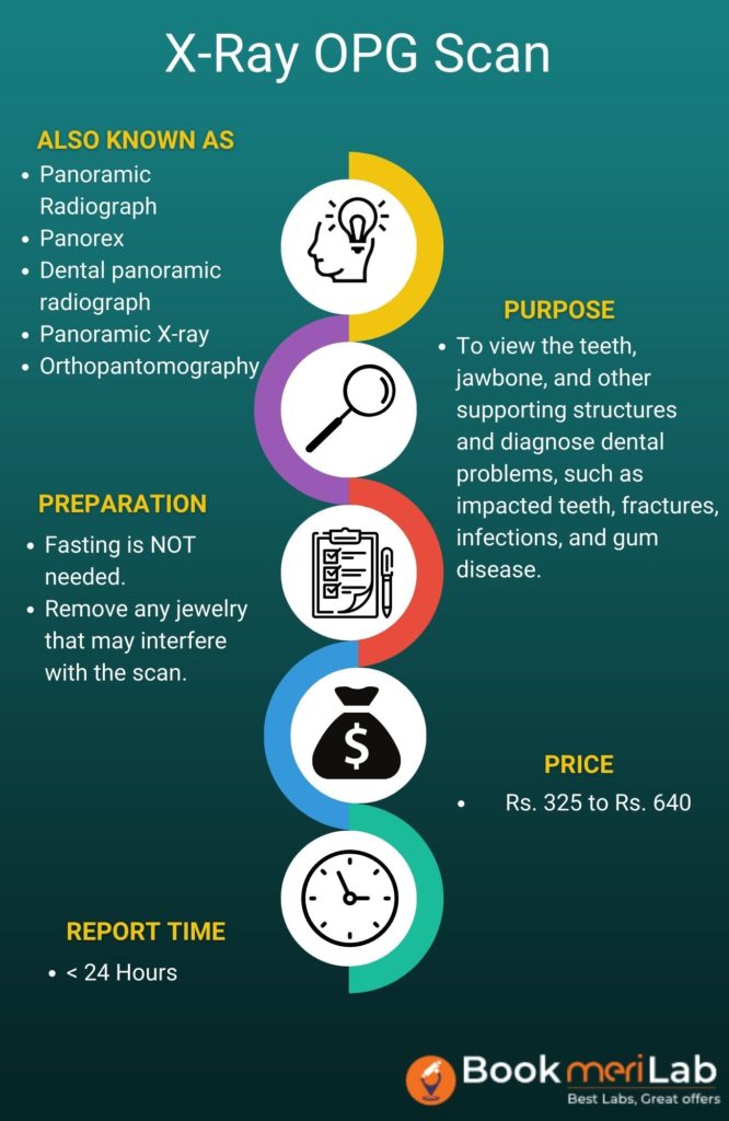 X Ray OPG Summary