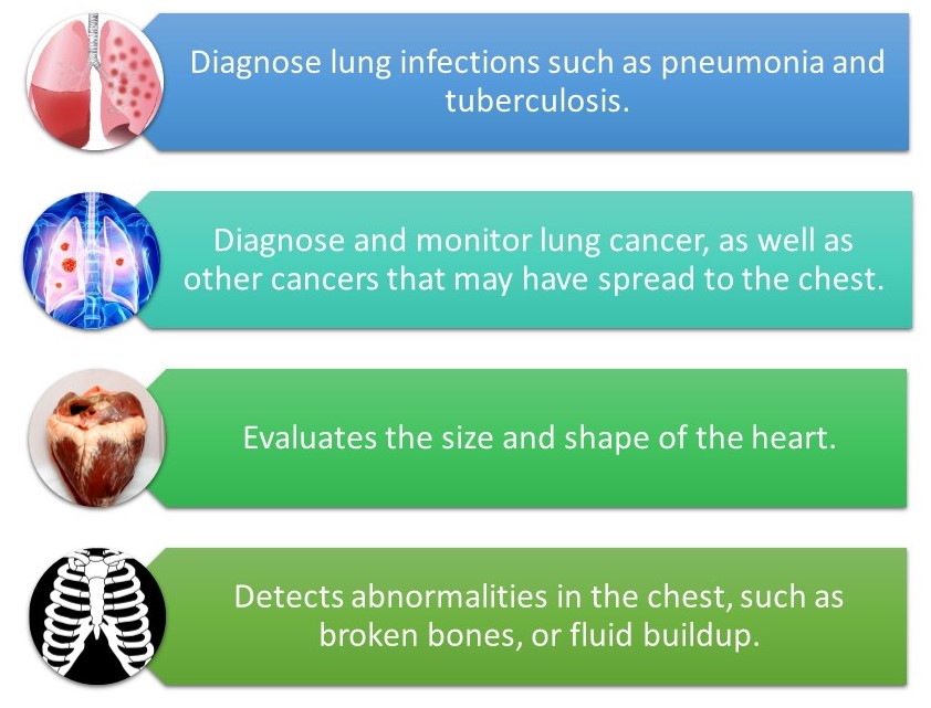 Purposes of Chest X-Ray
