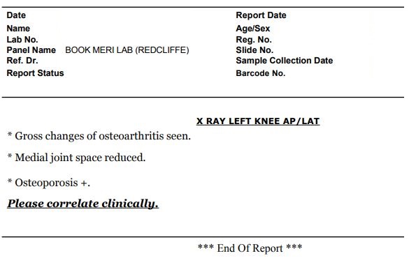 knee xray sample report