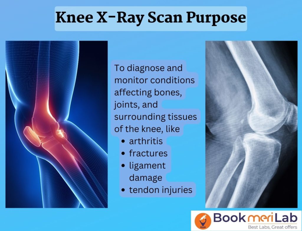 knee x-ray purpose