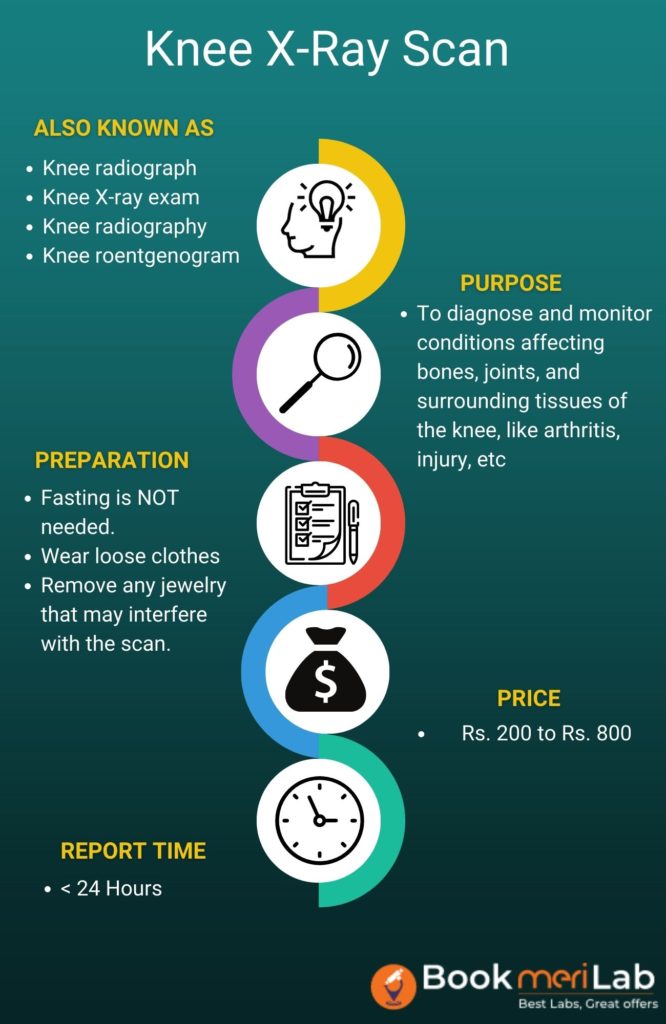 Knee X-Ray Test Summary