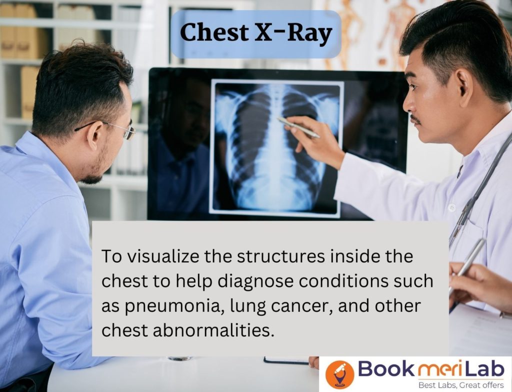 chest X-Ray purpose