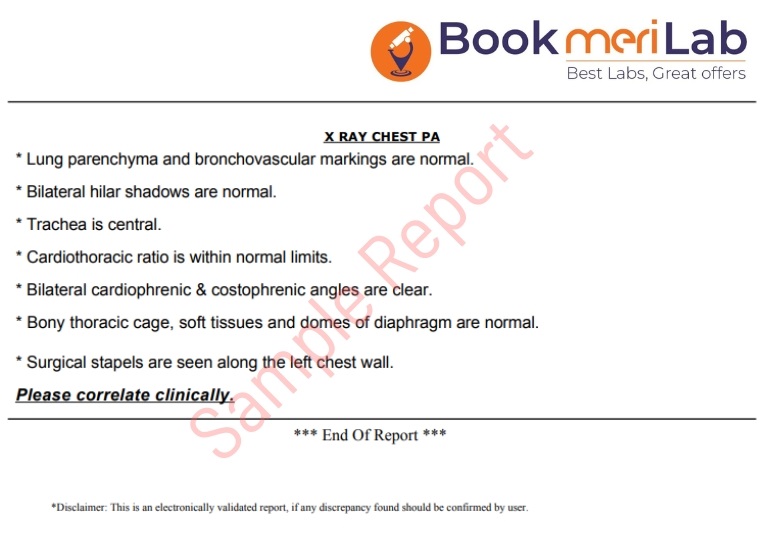 chest xray sample report