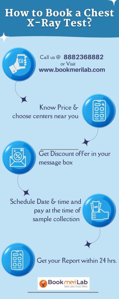 How to Book a Chest X-Ray