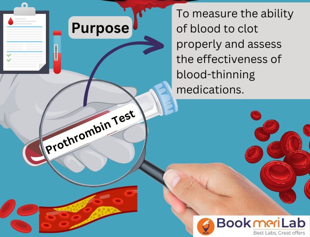 Prothrombin Time Test Purpose
