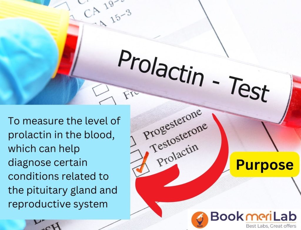 Prolactin test introduction