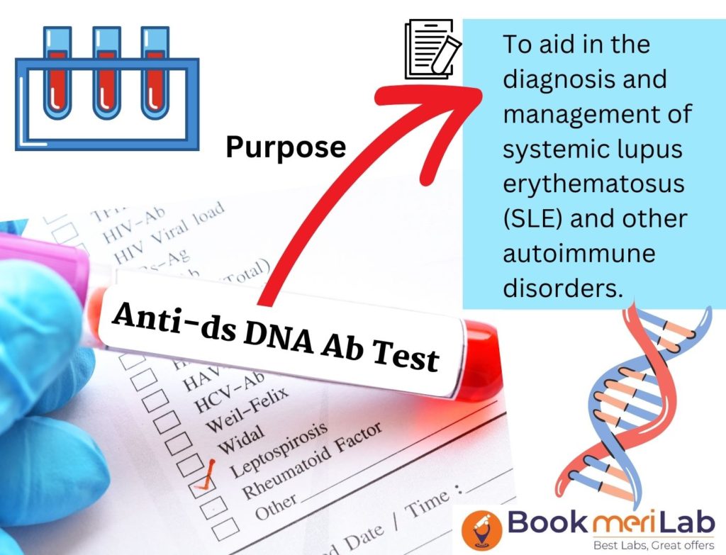 anti-dsDNA Test Introduction