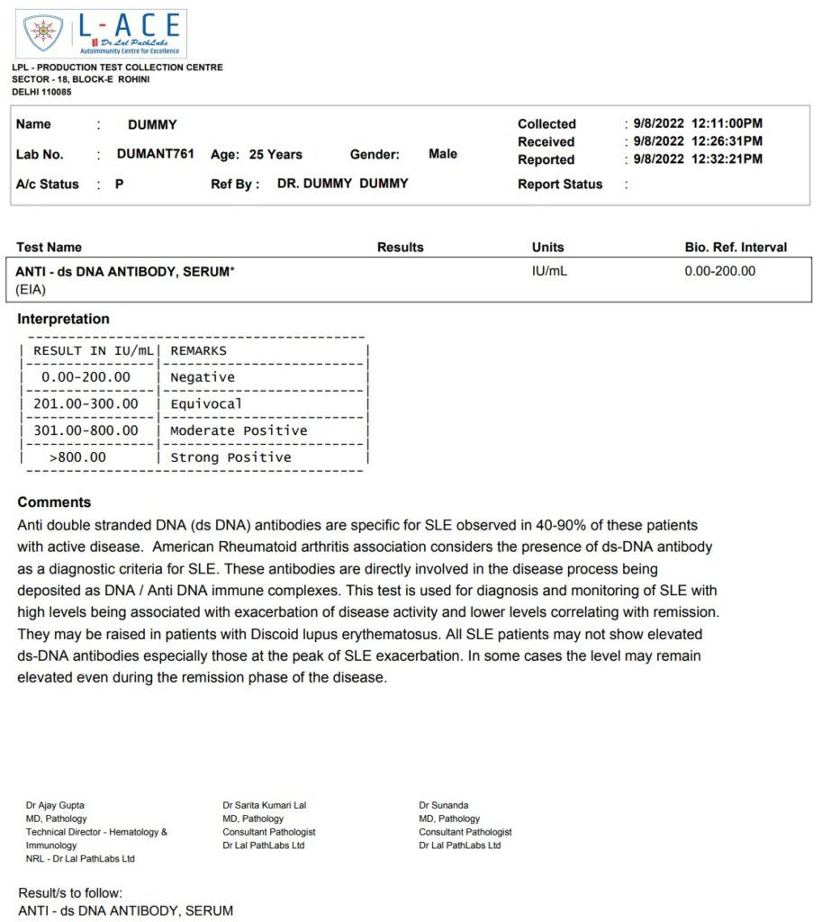 Anti ds dna test sample report