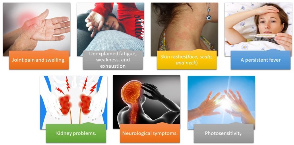 symptoms of SLE (Autoimmune disease)
